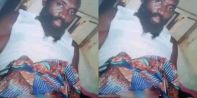 Nigerian Man cuts off his manhood because he wants to stop womanizing (photo) 1