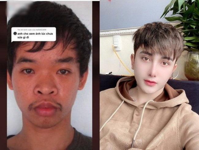 Young Man Changes His Looks Through Plastic Surgery After Not Getting A Job Because Of His Appearance - Photos