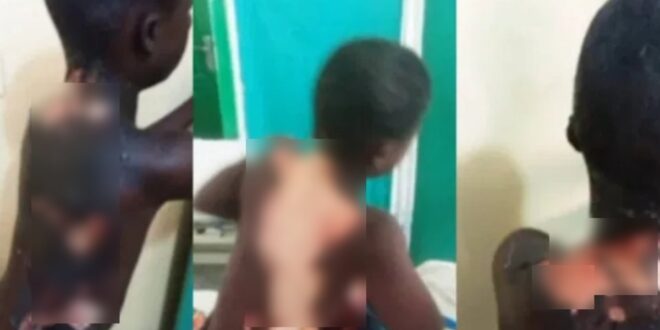 #Kosoa: Another 10-year-old boy set ablaze by angry weed-smoking teenager - Photos 1