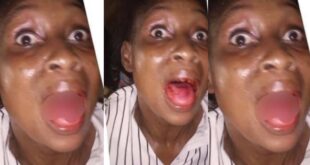Lady begs court to release abusive Husband after she lost her front teeth through a blow from her husband 13