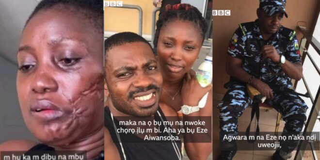 Video: My Police Boyfriend Shot Me In My Mouth -Lady shares sad story 1