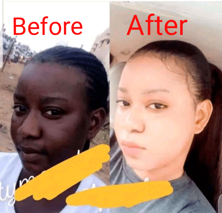 Dark Lady Storms The Internet With Her Before And After Photos 1